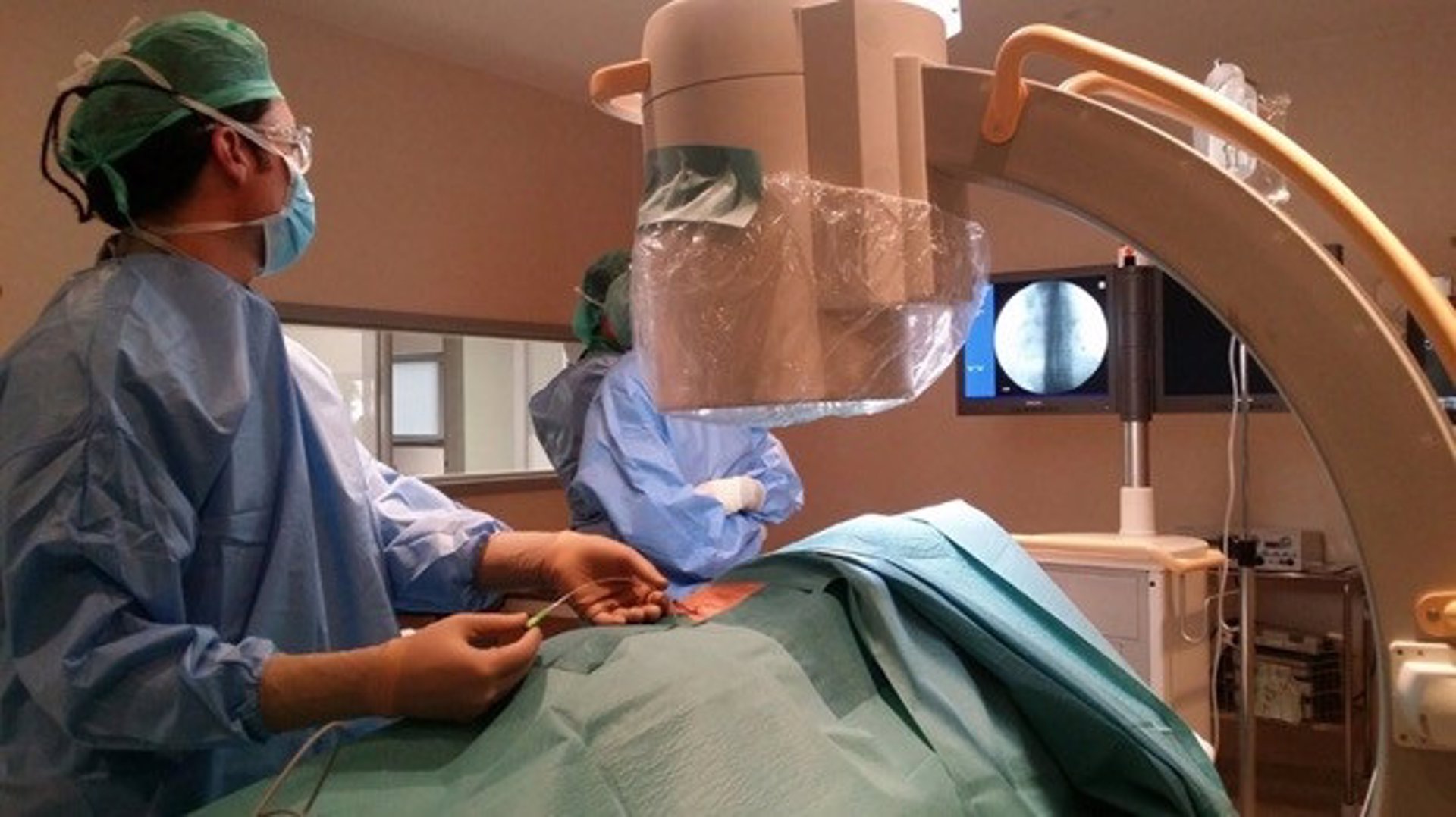 HM Málaga, primer hospital andaluz en implantar un nuevo electrodo percutáneo de estimulación de raíces sacras