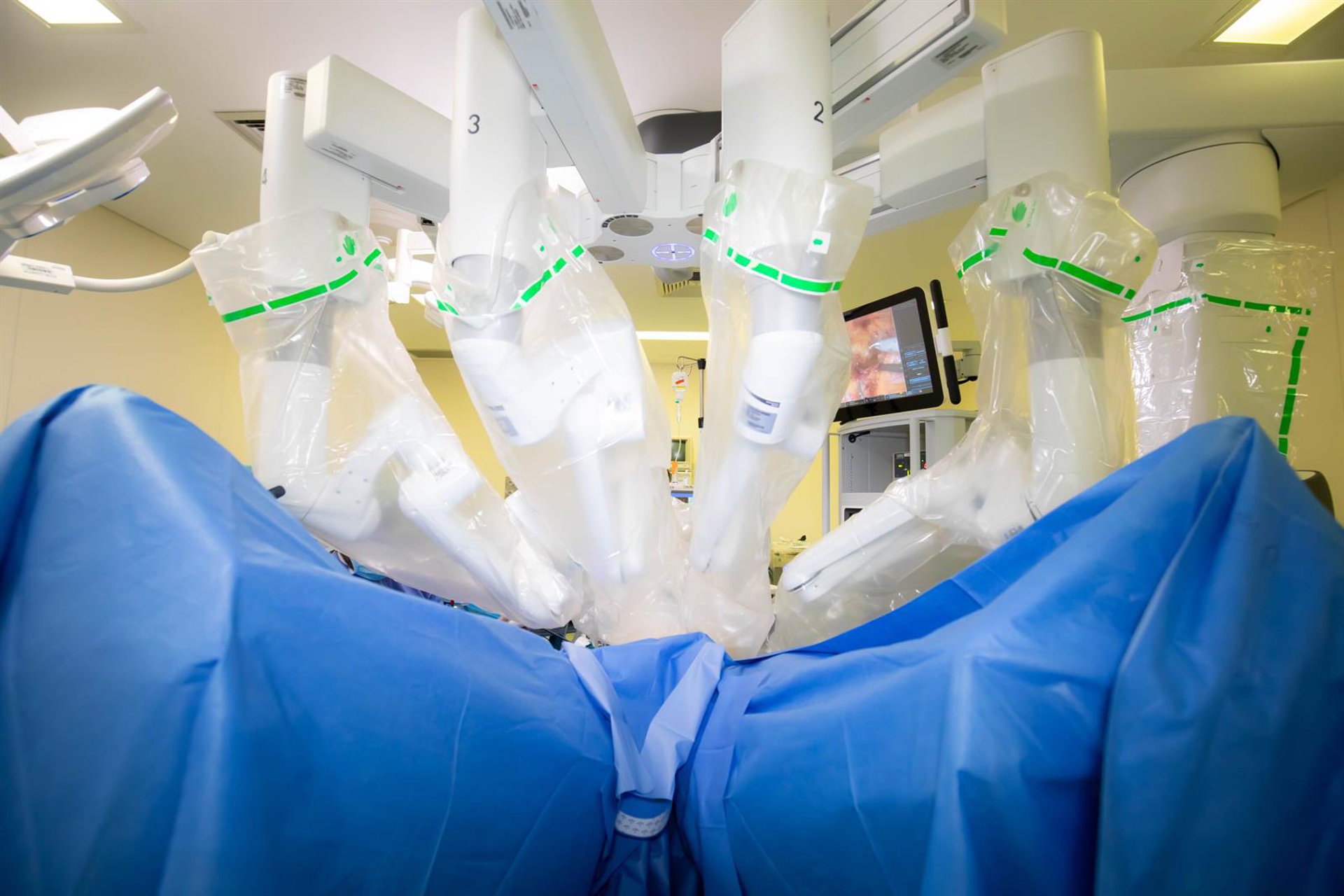 Vithas Málaga incorpora el robot quirúrgico 'Da Vinci' para la realización de cirugías de máxima precisión
