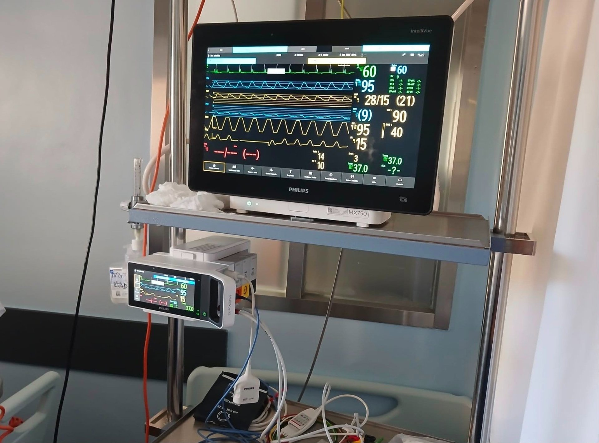 El Hospital de Antequera incorpora un nuevo sistema de monitorizacion para pacientes críticos