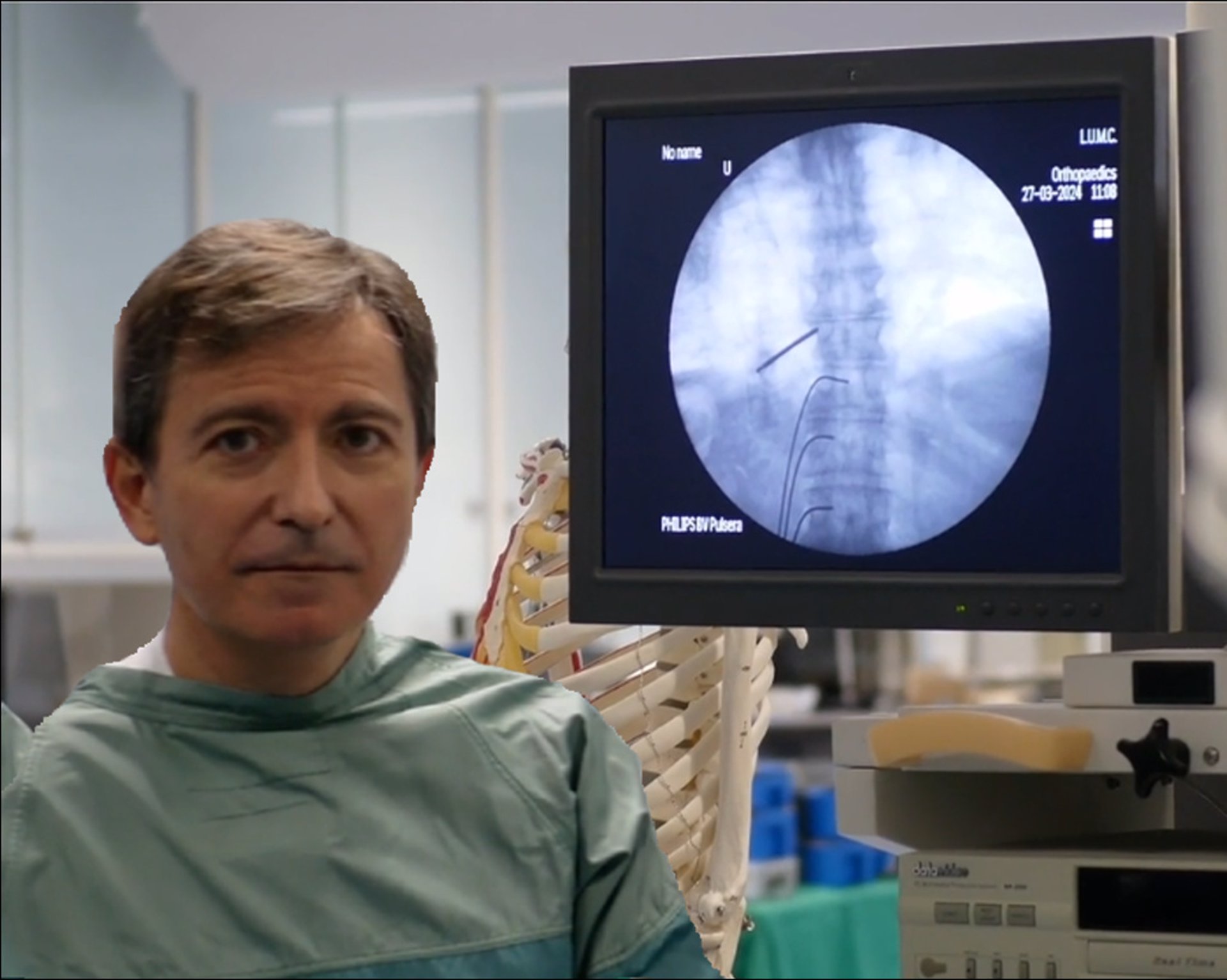 Expertos señalan que pacientes con fibromialgia responden peor a la infiltración del dolor lumbar crónico